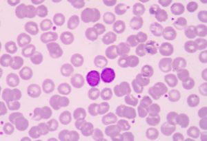 T-sejtek a vérben